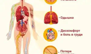 Сосудистая недостаточность