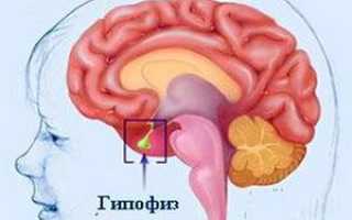 Недостаток гормона гипофиза или гипоталамо-гипофизарная недостаточность