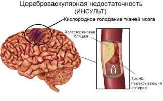 Суточный мониторинг артериального давления — особенности процедуры