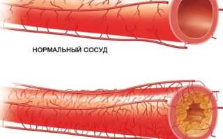 Что такое пульсовое давление, его нормы