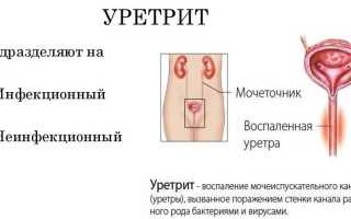 Уретрит