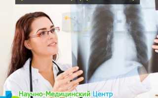 Что такое положительная динамика при туберкулезе