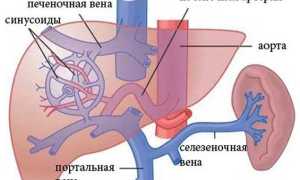 Признаки портальной гипертензии при циррозе печени и ее лечение