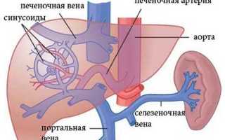 Признаки портальной гипертензии при циррозе печени и ее лечение
