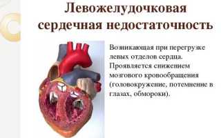 Формы левожелудочковой недостаточности, ее причины, неотложная помощь, лечение