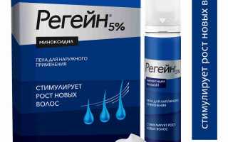 Регейн