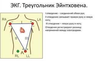Электрическая ось сердца (ЭОС): нормальные положения и отклонения