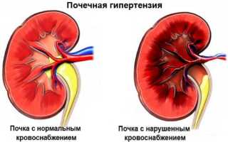 Почечное давление — что это такое, симптомы, как снизить