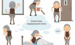 Недержание мочи у женщин