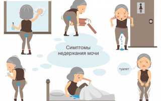 Недержание мочи у женщин
