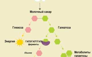 Галактоземия