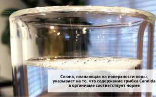 Как определить молочницу по слюне