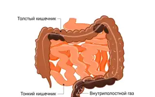 Запор