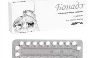 Бонадэ